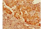 Immunohistochemistry of paraffin-embedded human adrenal gland tissue using CSB-PA009381LA01HU at dilution of 1:100