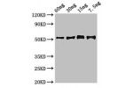 Western Blot<br />
Positive WB detected in Recombinant protein<br />
All lanes:Gamma-glutamy antibody at 2.7