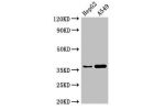 Western Blot<br />
Positive WB detected in:HepG2 whole cell lysate,A549 whole cell lysate<br />
All lanes:GGH antibody at 3