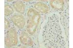 Immunohistochemistry of paraffin-embedded human kidney tissue using CSB-PA009404LA01HU at dilution of 1:100