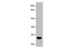 Western blot<br />
All lanes: GGTLC2 antibody at 2ug/ml+Mouse kidney tissue<br />
 Goat polyclonal to rabbit at 1/10000 dilution<br />
Predicted band size: 24 kDa<br />
 Observed band size: 24 kDa<br />
