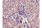 Immunohistochemistry of paraffin-embedded human liver tissue using CSB-PA009411LA01HU at dilution of 1:100