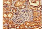 Immunohistochemistry of paraffin-embedded human kidney tissue using CSB-PA009435LA01HU at dilution of 1:100