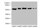 Western blot<br />
All lanes: GIPR antibody at 5.89ug/ml<br />
Lane 1 : Rat heart tissue<br />
Lane 2 : Mouse brain tissue<br />
Lane 3 : Hela whole cell lysate<br />
Lane 4 : A549 whole cell lysate<br />
Lane 5 : HL60 whole cell lysate<br />
Secondary<br