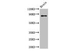 Western Blot<br />
Positive WB detected in:Mouse brain tissue<br />
All lanes:GIT1 antibody at 3.5