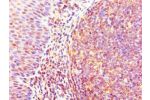 Immunohistochemistry of paraffin-embedded human tonsil using CSB-PA009443ESR2HU at dilution 1:100