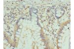 Immunohistochemistry of paraffin-embedded human small intestine tissue using CSB-PA009447LA01HU at dilution of 1:100