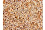 Immunohistochemistry of paraffin-embedded human adrenal gland tissue using CSB-PA009448LA01HU at dilution of 1:100