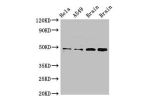 Western Blot<br />
Positive WB detected in:Hela whole cell lysate,A549 whole cell lysate,Rat brain tissue,Mouse brain tissue<br />
All lanes:GJA8 antibody at 2.5