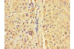 Immunohistochemistry of paraffin-embedded human liver tissue using CSB-PA009451LA01HU at dilution of 1:100