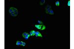 Immunofluorescent analysis of MCF-7 cells using CSB-PA009456LA01HU at a dilution of 1:100 and Alexa Fluor 488-congugated AffiniPure Goat Anti-Rabbit IgG(H+L)