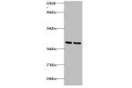 Western blot<br />
Lane 1 : 293T whole cell lysate<br />
Lane 2 : EC109 whole cell lysate<br />
Secondary<br />
Goat polyclonal to Rabbit IgG at 1/15000 dilution<br />
Predicted band size: 51,46 kDa<br />
Observed band size: 49 kDa,35 kDa,40 kDa,55 kDa,80