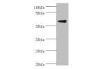 Western blot<br />
All lanes:Glycerol kinase 2 antibody at 2ug/ml+jurkat whole cell lysate<br />
Secondary<br />
Goat polyclonal to rabbit at 1/10000 dilution<br />
Predicted band size: 61kDa<br />
Observed band size: 61kDa<br />