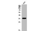 Western Blot analysis of 293T cells using ApoE Polyclonal Antibody