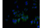 Immunofluorescent analysis of HepG2 cells using CSB-PA009503LA01HU at a dilution of 1:100 and Alexa Fluor 488-congugated AffiniPure Goat Anti-Rabbit IgG(H+L)