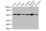 Western Blot<br />
Positive WB detected in:Mouse liver tissue,Mouse spleen tissue,Mouse lung tissue,Mouse stomach tissue,Mouse skeletal muscle tissue,Mouse placenta tissue<br />
All lanes:Glp1r antibody at 3ug/ml<br />
Secondary<br />
Goat polyclonal to r