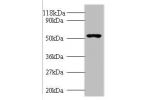 All lanes: Glucagon-like peptide 1 receptor antibody at 2ug/ml+293T whole cell lysate<br />
Secondary<br />
Goat polyclonal to rabbit at 1/10000 dilution<br />
Predicted band size: 53kDa<br />
Observed band size: 53kDa<br />