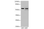 Western blot<br />
All lanes: Glucagon-like peptide 1 receptor antibody at 12ug/ml<br />
Lane 1 : Mouse heart tissue<br />
Lane 2 : 293T whole cell lysate<br />
Secondary<br />
Goat polyclonal to Rabbit IgG at 1/10000 dilution<br />
Predicted band size: 5