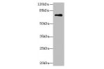 Western blot<br />
All lanes: GLS antibody at 5ug/ml+Mouse brain tissue<br />
Goat polyclonal to rabbit at 1/10000 dilution<br />
Predicted band size: 74,18,66 kDa<br />
Observed band size: 73 kDa<br />