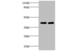 Western blot<br />
All lanes:Glycosyltransferase 8 domain-containing protein 2 antibody at 2ug/ml<br />
Lane 1:mouse heart tissue<br />
Lane 2:mouse kidney tissue<br />
Secondary<br />
Goat polyclonal to rabbit at 1/10000 dilution<br />
Predicted band siz
