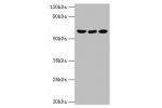 Western blot<br />
All lanes:Glutamate dehydrogenase 2, mitochondrial antibody at 2ug/ml<br />
Lane 1:mouse brain tissue<br />
Lane 2:293T whole cell lysate<br />
Lane 2:rat brain tissue<br />
Secondary<br />
Goat polyclonal to rabbit at 1/10000 dilution<