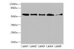 Western blot<br />
All lanes: