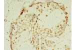 Immunohistochemistry of paraffin-embedded human testis tissue using CSB-PA009577LA01HU at dilution of 1:100