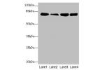 Western blot<br />
All lanes: