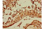 Immunohistochemistry of paraffin-embedded human testis tissue using CSB-PA009583LA01HU at dilution of 1:100