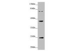 Western blot<br />
All lanes:GNA15 antibody at 1.41 ug/ml<br />
 +Mouse liver tissue<br />
Secondary<br />
Goat polyclonal to rabbit IgG at 1/10000 dilution<br />
Predicted band size: 44 kDa<br />
Observed band size: 44,24,72 kDa<br />