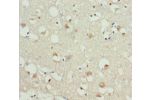 Immunohistochemistry of paraffin-embedded human brain tissue using CSB-PA009593DSR2HU at dilution 1:100