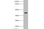 Western blot<br />
All lanes:Guanine nucleotide-binding protein G(o) subunit alpha antibody at 2ug/ml+rat brain tissue<br />
Secondary<br />
Goat polyclonal to Rabbit IgG at 1/10000 dilution<br />
Predicted band size: 40kDa<br />
Observed band size: 40kDa
