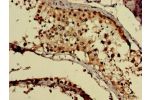 Immunohistochemistry of paraffin-embedded human testis tissue using CSB-PA009594LA01HU at dilution of 1:100