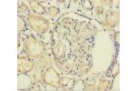 Immunohistochemistry of paraffin-embedded human kidney tissue using CSB-PA009608LA01HU at dilution 1:100