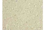 Immunohistochemistry of paraffin-embedded human brain tissue using CSB-PA009611LA01HU at dilution of 1:100