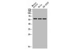 Western blot analysis of mouse-brain HELA SH-SY5Y lysis using Arylsulfatase E antibody.