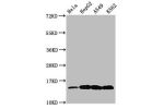 Western Blot<br />
Positive WB detected in:Hela whole cell lysate,HepG2 whole cell lysate,A549 whole cell lysate,K562 whole cell lysate(all treated by 30mM sodium butyrate for 4h)<br />
All lanes:H2AFZ antibody at 0.48