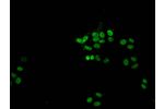 Immunofluorescent analysis of HepG2 (sodium butyrate,30 mM, 4h) cells using CSB-PA010376PA21acHU at a dilution of 1:100 and Alexa Fluor 488-congugated AffiniPure Goat Anti-Rabbit IgG(H+L)