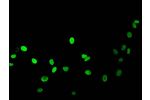 Immunofluorescent analysis of HepG2 cells (sodium butyrate,30 mM, 4h) using CSB-PA010377PA16acHU at a dilution of 1:100 and Alexa Fluor 488-congugated AffiniPure Goat Anti-Rabbit IgG(H+L)