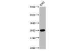 Western Blot<br />
Positive WB detected in:K562 whole cell lysate(all treated by 30mM sodium butyrate for 4h)<br />
All lanes:HIST1H1C antibody at 0.64