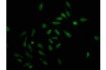 Immunofluorescence staining of hela with CSB-PA010378OA159forHU,counter-stained with DAPI. The cells were fixed in 4% formaldehyde, permeabilized using 0.2% Triton X-100 and blocked in 10% normal Goat Serum. The cells were then incubated with the antibody