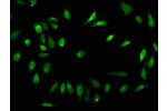 Immunofluorescence staining of Hela cells with CSB-PA010378OA84forHU,counter-stained with DAPI. The cells were fixed in 4% formaldehyde, permeabilized using 0.2% Triton X-100 and blocked in 10% normal Goat Serum. The cells were then incubated with the ant