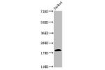 Western Blot<br />
Positive WB detected in:Jurkat whole cell lysate(all treated by 30mM sodium butyrate for 4h)<br />
All lanes:HIST1H1C antibody at 2.2