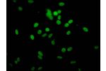Immunofluorescent analysis of Hela cells (sodium butyrate,30 mM, 4h) using CSB-PA010378PA51hibHU at a dilution of 1:100 and Alexa Fluor 488-congugated AffiniPure Goat Anti-Rabbit IgG(H+L)
