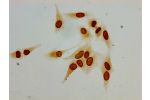 Immunocytochemistry analysis of Hela cells using CSB-PA010378PA62acHU at dilution of 1:100