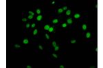 Immunofluorescent analysis of Hela (sodium butyrate,30 mM, 4h) cells using CSB-PA010378PA63hibHU at a dilution of 1:100 and Alexa Fluor 488-congugated AffiniPure Goat Anti-Rabbit IgG(H+L)