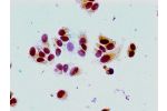 Immunocytochemistry analysis of MCF-7 cells using CSB-PA010380PA16acHU at dilution of 1:100