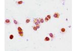 Immunocytochemistry analysis of MCF-7 cells using CSB-PA010380PA33acHU at dilution of 1:100