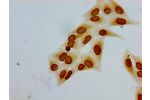 Immunocytochemistry analysis of Hela cells using CSB-PA010380PA51acHU at dilution of 1:100