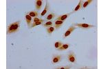 Immunocytochemistry analysis of Hela cells using CSB-PA010380PA63acHU at dilution of 1:100